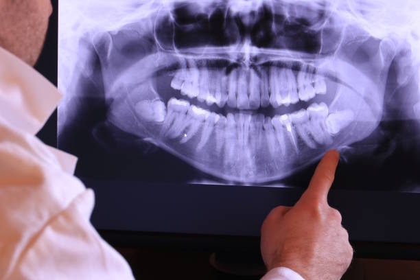 Best Dentist for Tooth Abscess  in Golden Gate, FL